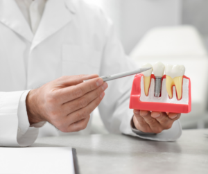 Dental Implants in Nashville