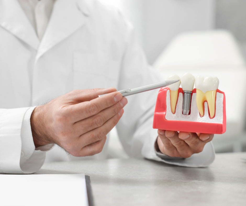 Dental Implants in Nashville